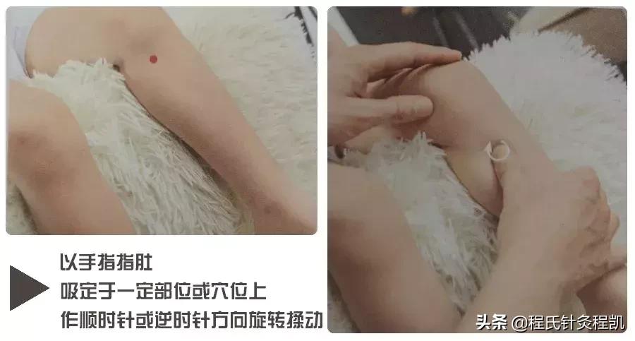 湿疹推拿要清脾还是补脾,小儿湿疹的推拿方法