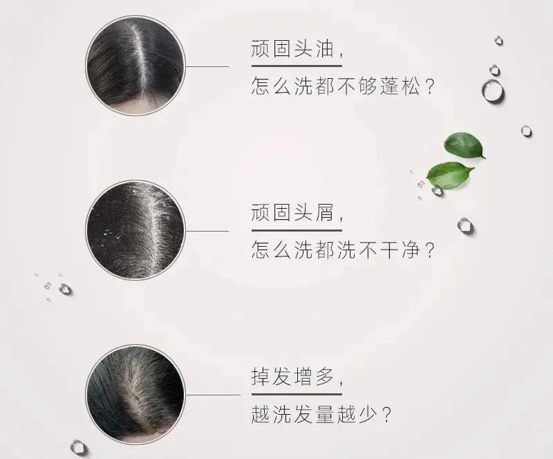 去头皮角质的正确方法,头皮角质层去除用什么方法