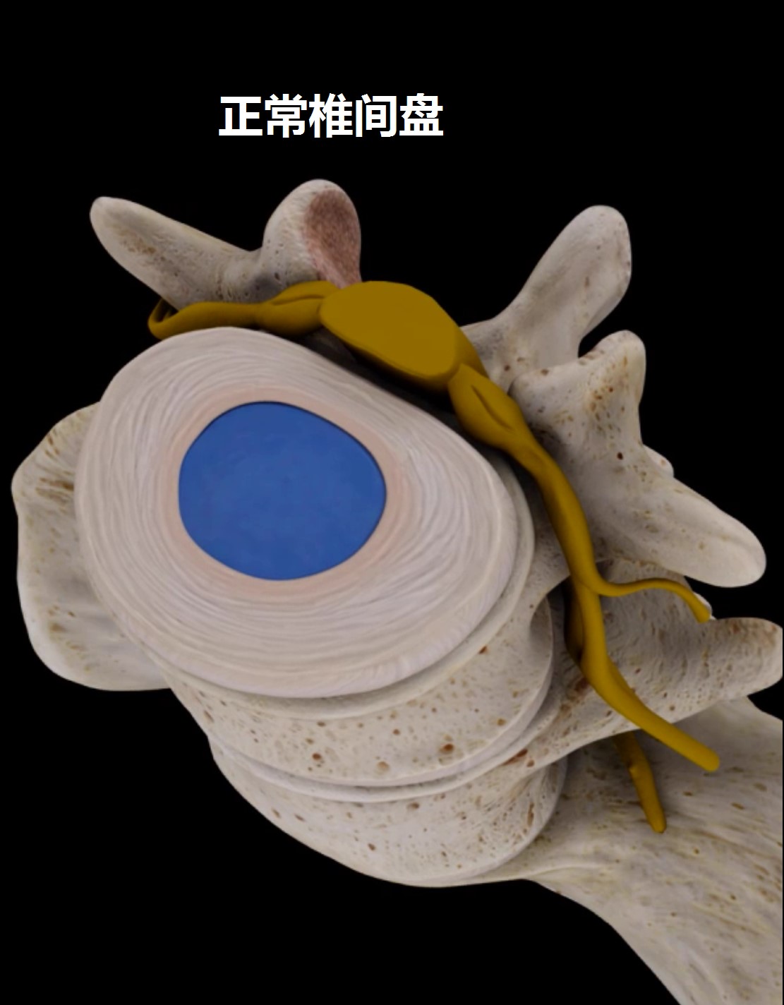 上班族该怎么预防腰痛,腰痛要警惕四种原因及治疗方法