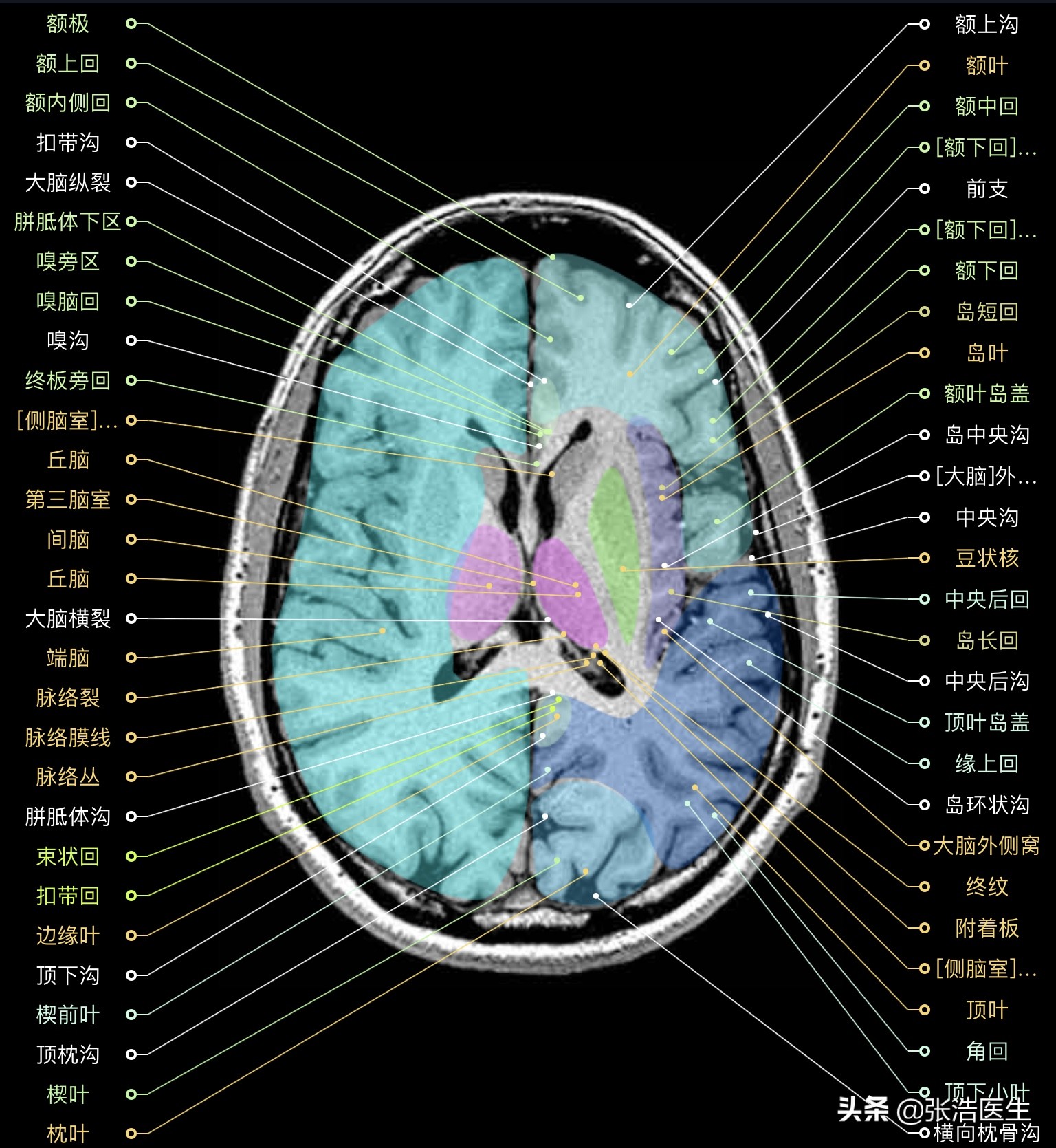 颅脑mri断层解剖视频课件,颅脑mri解剖手绘图