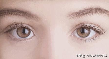 做了埋线为什么感觉睁不开眼睛,之前是埋线再做全切有影响吗