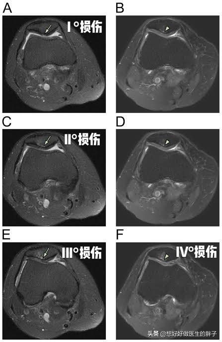 长时间骑自行车手腕疼,骑自行车膝盖上方酸痛是怎么回事