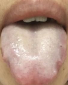 暴雨、回南天，3种舌相3道木棉花食不可错过