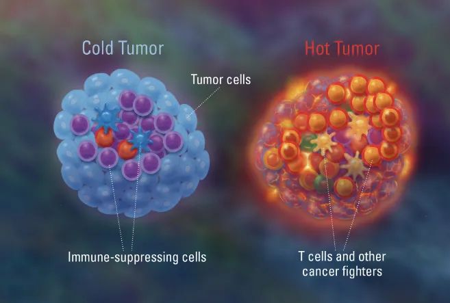 为什么免疫治疗后肿瘤不缩小,为什么免疫治疗不适合胃癌