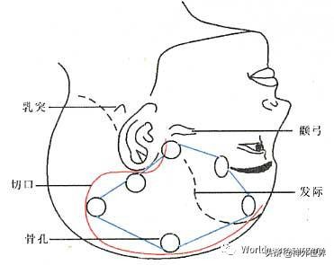 头皮裂伤缝合手术切口分类,头皮切口