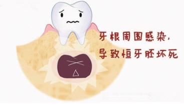 父母必看孩子教育,父母换牙需要注意什么