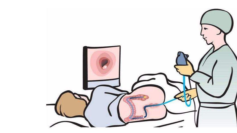 痔疮出血休克是什么原因,痔疮出血不能吃什么药