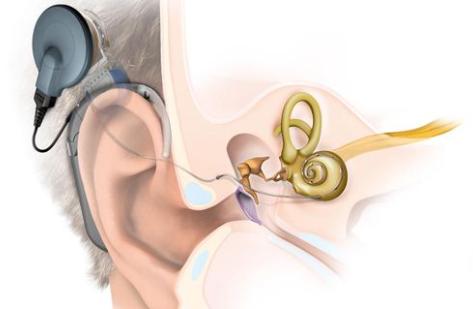 脑血管核磁共振具体检查过程,脑血管核磁共振前要注意什么