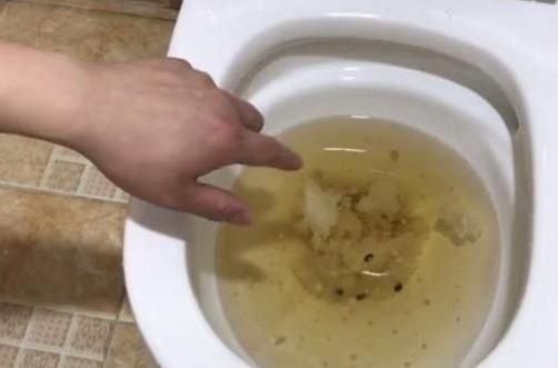 家里马桶堵了可以用手直接疏通吗,马桶堵了泥鳅可以通马桶吗