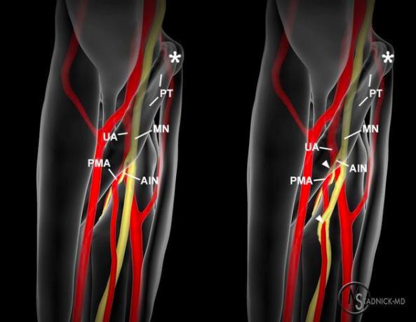 进化论能揭示人类奥秘,人类进化论的另一项有力证据