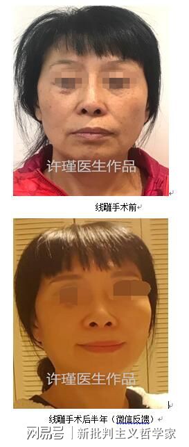 名医专访丨上海交通大学医学院附属同仁医院许瑾：面部美容整形