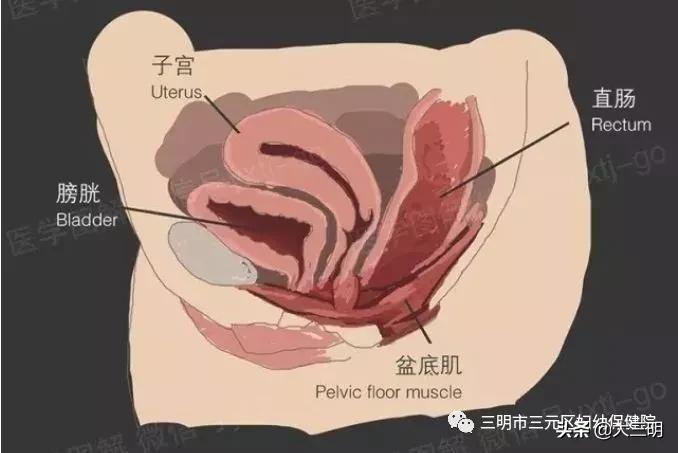 产后盆腔器官脱垂如何预防,女性产后漏尿怎么治才能除根