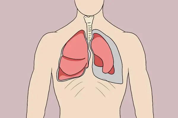 阿莫西林并非万能消炎药！不了解禁忌就乱用，容易伤身体