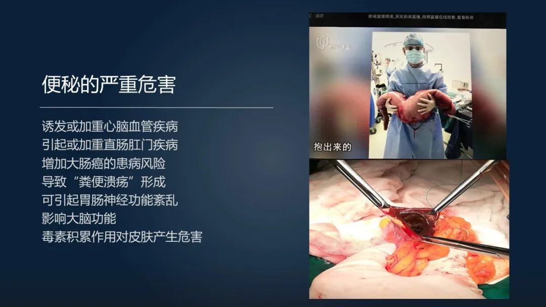 一招调理肠道改善便秘,肠道水疗治便秘有效吗