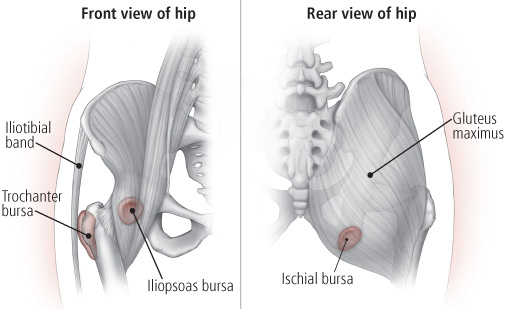 股骨大转子滑囊炎吃头孢有效果吗,股骨大转子滑囊炎小针刀治疗视频
