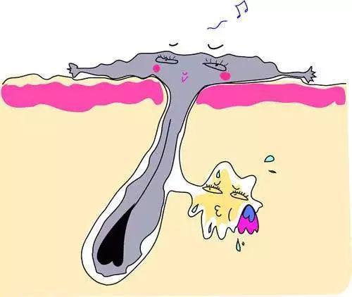 如何疏通脸上毛孔收缩毛孔,脸上毛孔粗大用什么就会收缩毛孔