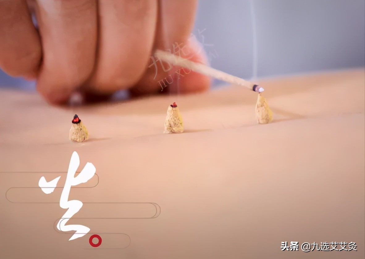 艾条艾灸的正确方法,艾灸的5大禁忌及10个注意事项