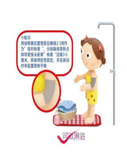 不可不知道的PICC置管后的居家护理