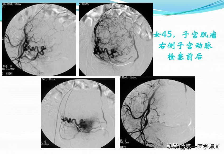「医影传声」上海交通大学医学院附属瑞金医院卢湾分院放射科主任