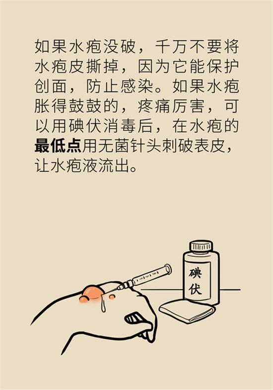 烧伤有水泡创面如何处理,烧伤烫伤起泡怎么处理