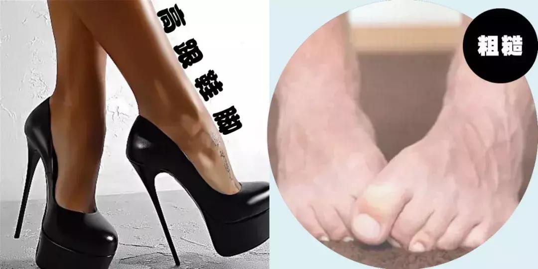 脚拇外翻怎么办教你一招,你的脚好丑的意思