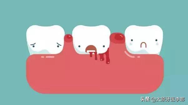 牙龈肿痛是哪里上火吃什么中药,上火牙龈肿痛最见效的泻火方法