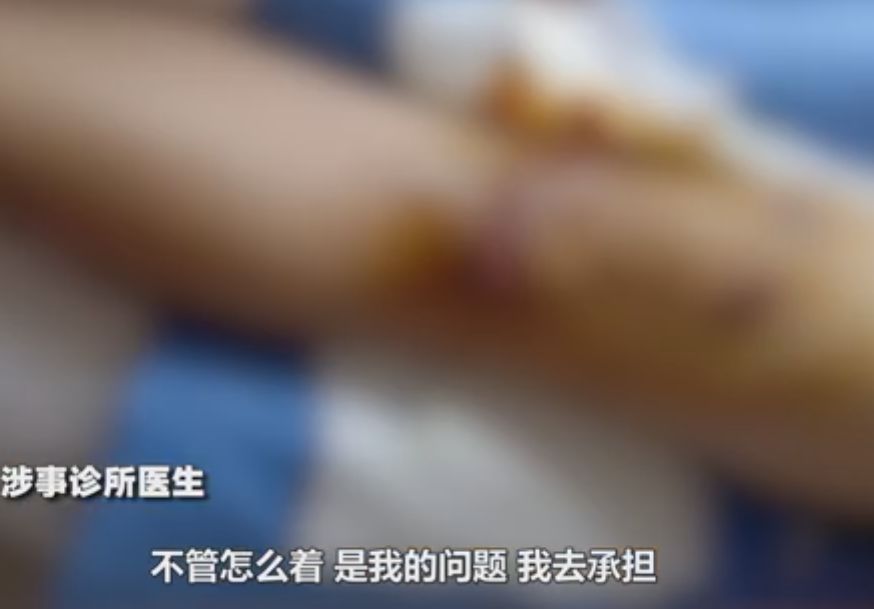 针灸后感染病例,针灸后针孔化脓