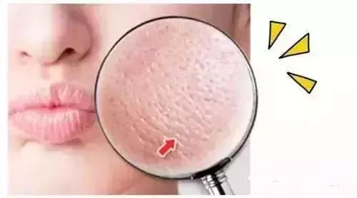 万年毛孔去不掉？那是你没用对方法