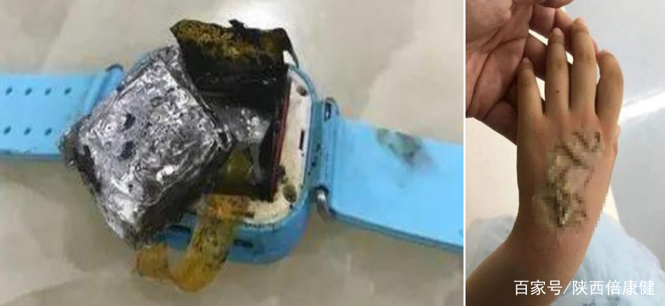 杂牌儿童电话手表自燃,多少温度下儿童电话手表会自燃