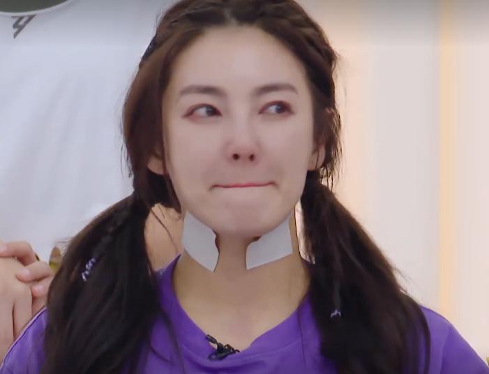 张雨绮腰疼,张雨绮脖子贴的什么