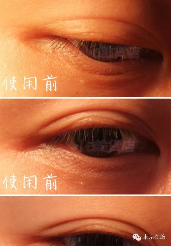 日本蛇毒眼膜官方旗舰店,日本蛇毒眼膜真的有用吗