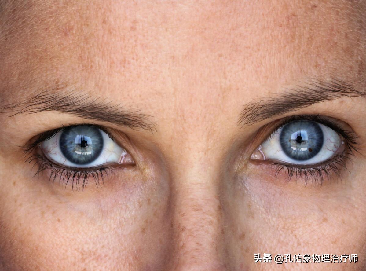 年轻人去除老年斑最有效的方法,老年斑怎么去除几大妙招抢先看