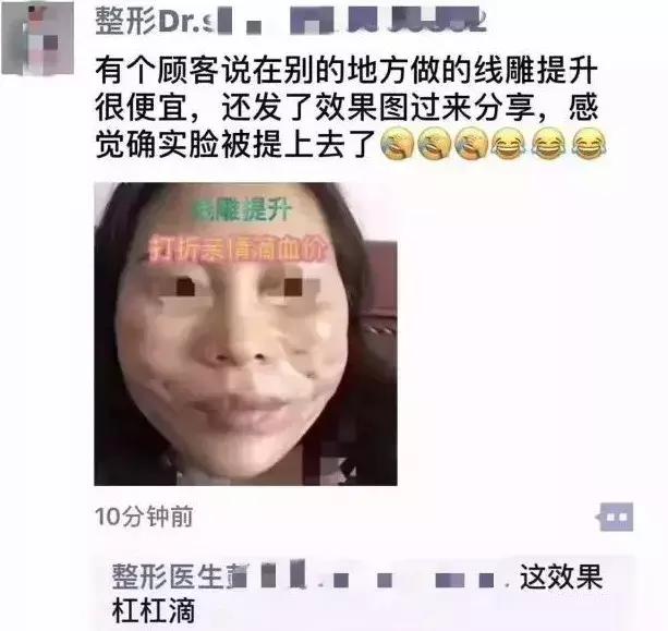 线雕贵还是玻尿酸贵,线雕的线贵不贵