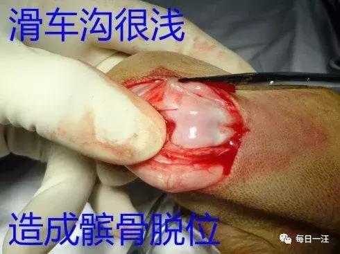 狗狗为什么会突然瘫痪,狗狗突然瘫痪站不起来怎么治疗