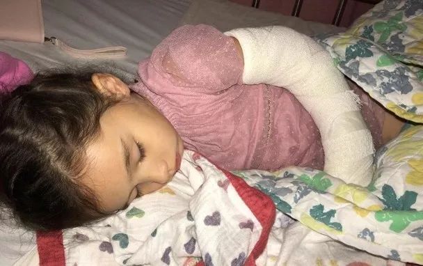 4岁女孩意外断臂,4岁女孩摔伤离世