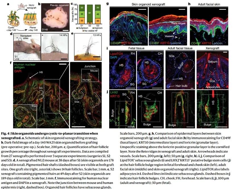 秃头还可以挽救吗,治愈秃头的好方法