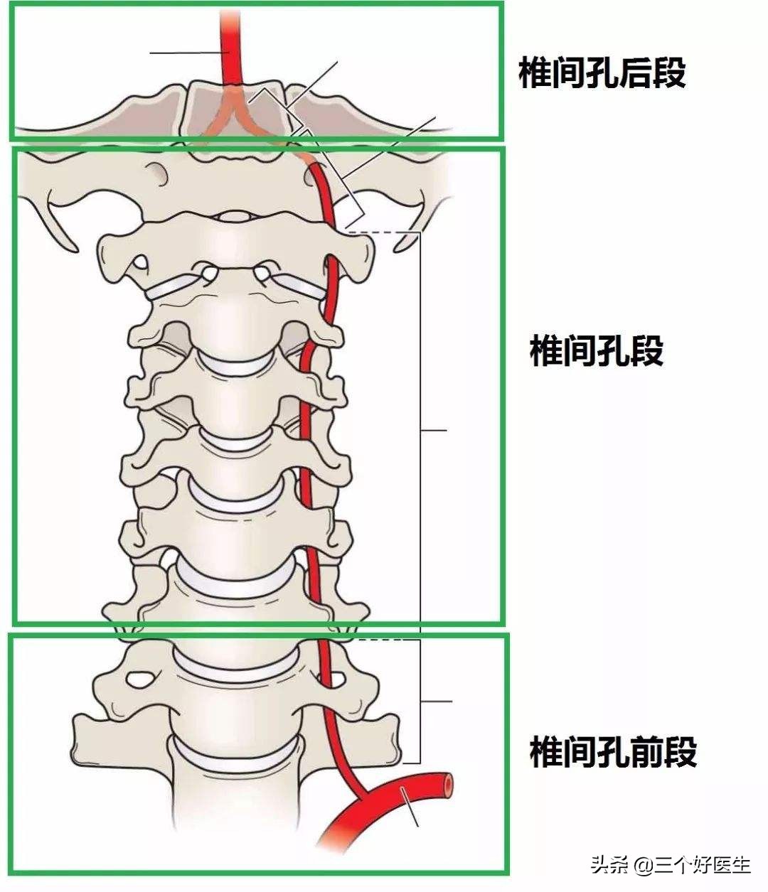 良性阵发性位置性眩晕手法复位,耳源性眩晕症怎么复位