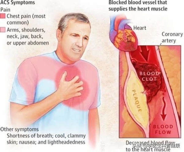 你有肩颈痛的症状吗,肩膀疼的原因和解决方法