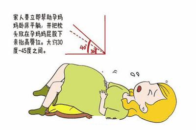 孕晚期破水注意哪些事项,孕晚期破水后怎么预防宫缩