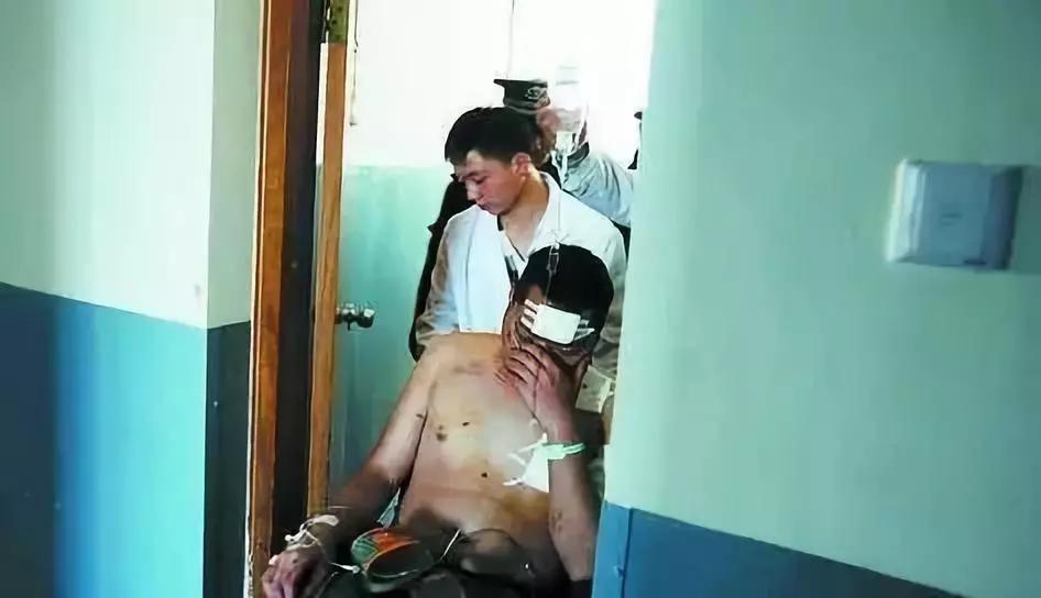 过期灭火器事故分析,干粉灭火器爆炸伤人案例