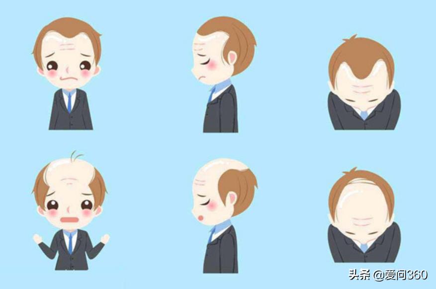 家族性脱发的男生要怎样预防脱发,中年脱发最好补救方法