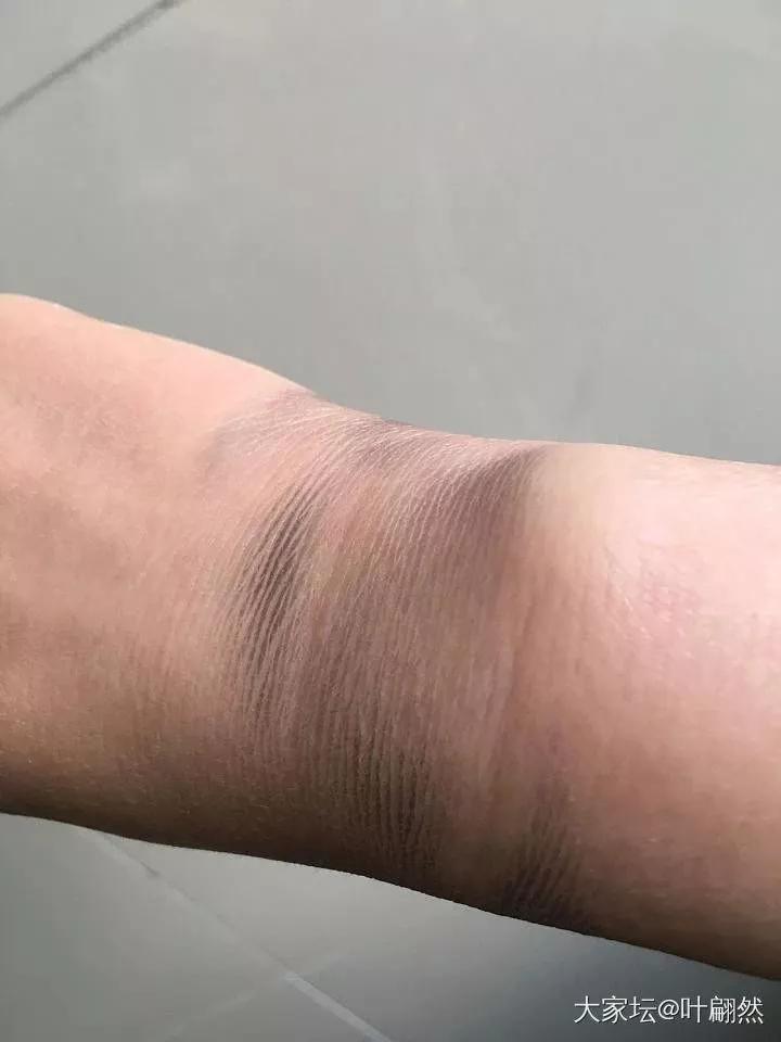 为什么戴银镯手腕一圈总发黑？