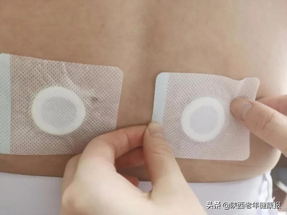 「冬病夏治」皮肤科“三伏贴”给您面子