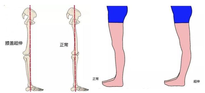 荒野健康:手把手1V1教你瘦腿,不再盲目训练啦