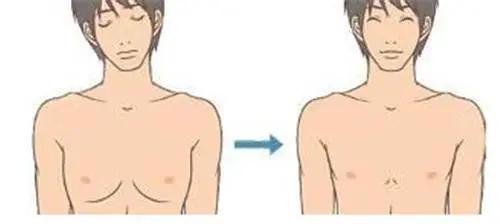 胸大容易得乳房疾病吗,男的胸大了是乳腺发育了吗