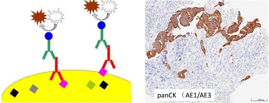 显微镜下的万花世界——走进病理学