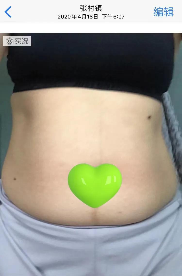 轻断食快速减内脏脂肪,轻断食减脂的正确方法