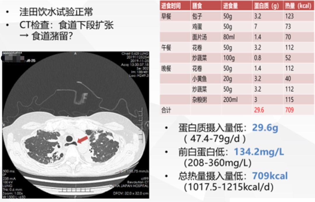 肺动脉高压患者咳嗽有血去哪治疗,肺动脉高压患者能进行呼吸康复吗