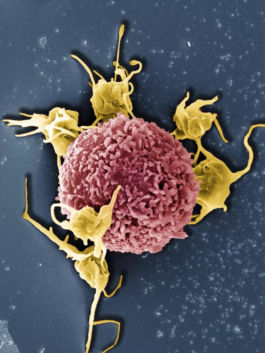 鍋囧鐥呮瘨鎰熸煋浜嗘垜,鍋囧鐥呮瘨鎰熸煋浜嗕綘