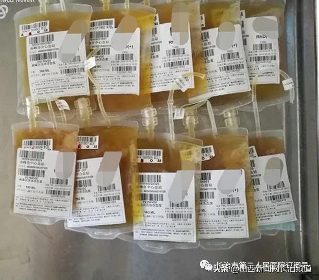 长治二院利用血浆置换术成功救治1名皮肌炎重叠干燥综合症患者